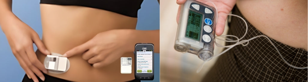 Cómo Funciona una Bomba de Insulina: Guía Completa para Entender su Us ...